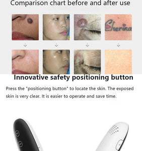 Newest Laser Picosecond Pen Freckle Tattoo Removal Mole Dark Spot Eyebrow Pigment Laser Acne Treatment Machine Beauty Care
