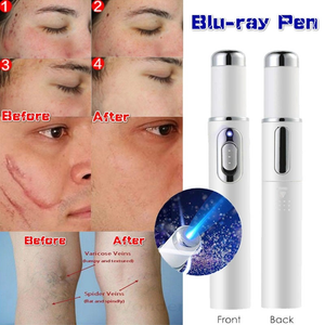 Portable Medical Blue Light Therapy Acne Laser Pen Skin Spots Removal Pen Anti Varicose Spider Vein Eraser Treatment