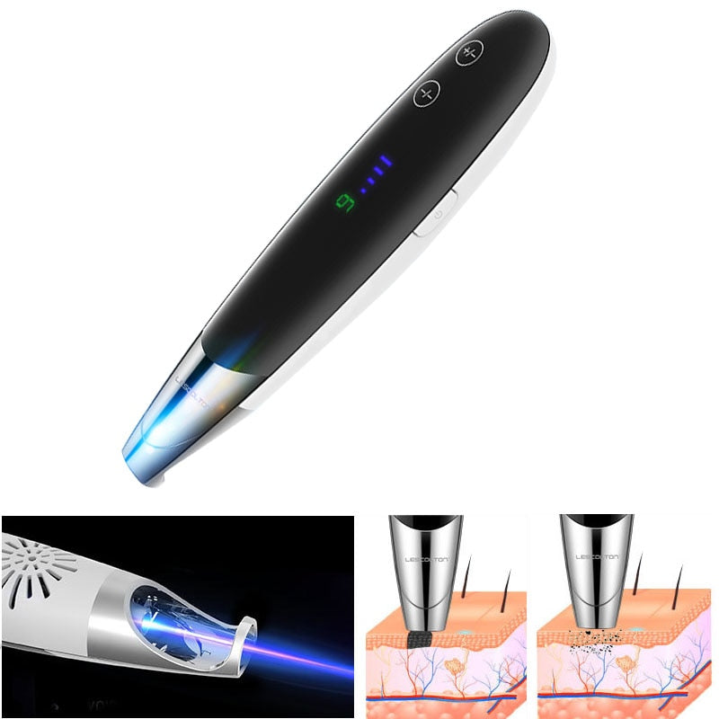 Newest Laser Picosecond Pen Freckle Tattoo Removal Mole Dark Spot Eyebrow Pigment Laser Acne Treatment Machine Beauty Care